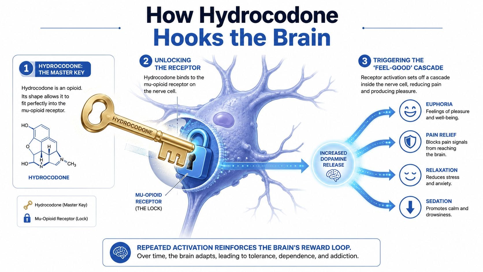 An infographic illustrating how hydrocodone binds to mu-opioid receptors in the brain to cause pain relief and addiction.